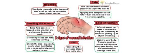 The Five Signs Of Wound Infection | Injuries, Fractures and Burns ...