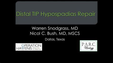 Distal Tip Snodgrass Hypospadias Repair With Dr Bush And Dr Snodgrass Youtube