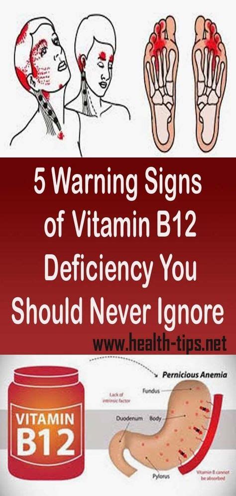 5 Warning Signs Of Vitamin B12 Deficiency You Should Never Ignore With