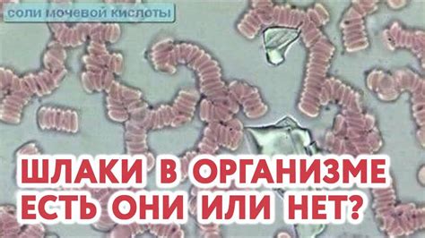 Шлаки в организме человека. Есть они или нет их? - YouTube