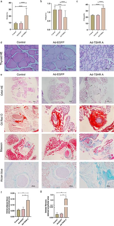 A B C ELISA And Quantitative Analysis Of FT4 TSH And TRAb In The