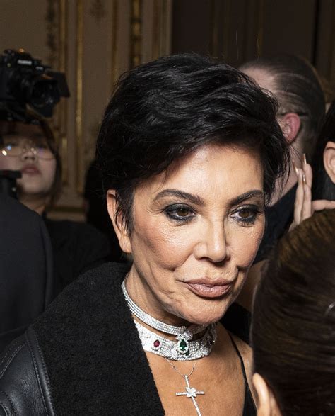 Kris Jenner Critics Horrified Over Her Deflated Nostril In Shocking