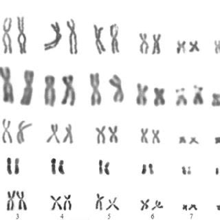 Karyotype of five Bufonidae species: A – Rhinella achalensis; B –... | Download Scientific Diagram