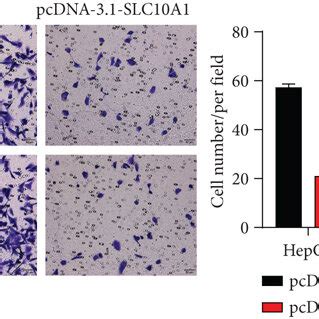 SLC10A1 Expressed Lowly In HCC Cells And Suppressed Its Proliferation