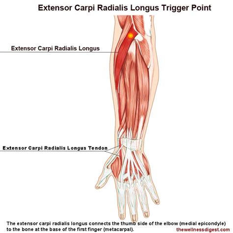 Extensor Carpi Radialis Longus Getbodysmart 58 Off