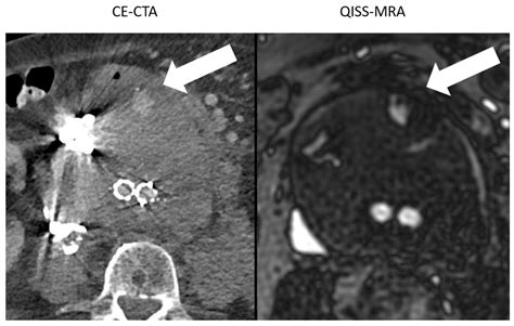 Jcm Free Full Text Clinical Evaluation Of Non Contrast Enhanced Radial Quiescent Interval