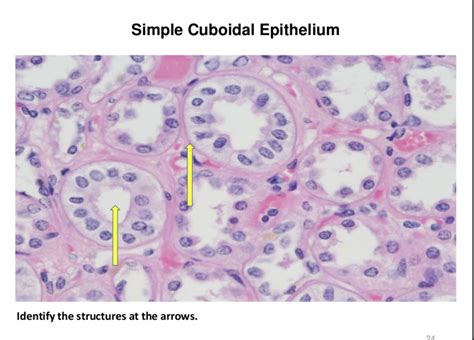 Simple Cuboidal Epithelium Labeled Basement Membrane