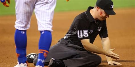 Mlb Video Del Brutal Pelotazo Al Rostro Que Recibi Umpire En El