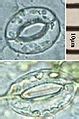 categorystoma wikimedia commons