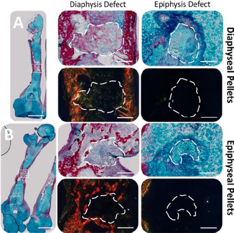 Ex Vivo Bone Defect Regeneration Following Implantation Of