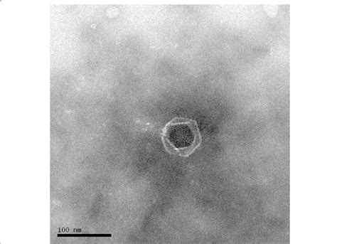 Transmission Electron Micrograph Of Dinoroseobacter Shibae Dfl Phage