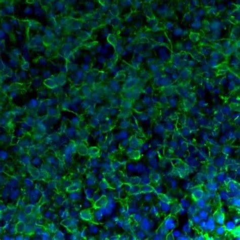 Tau Monoclonal Antibody TAU 5 Invitrogen 100 μg Unconjugated