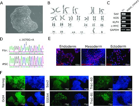 Characterization Of The Ipsc Line Download Scientific Diagram