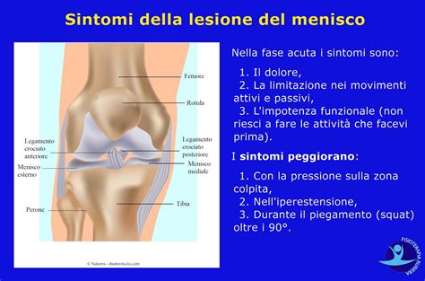 Lesione Del Menisco E Dei Legamenti Sintomi Cura E Tempi Di Recupero