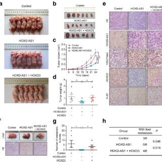 Hoxd As Suppresses Crc Cell Proliferation Cell Cycle Progression