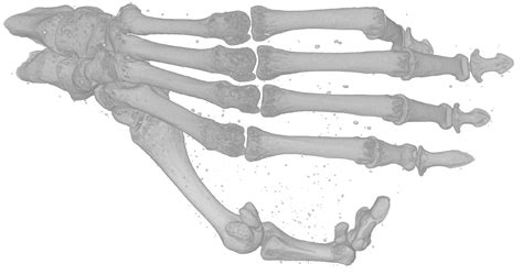 Fossils show ancient primates had grooming claws as well as nails – Research News