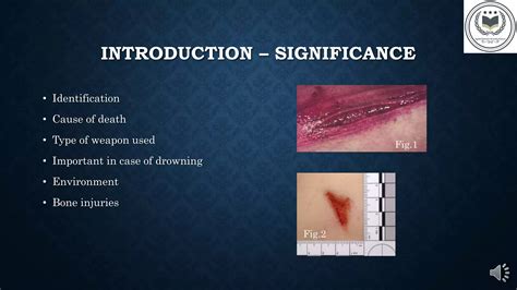 Antemortem and Postmortem Wounds.pptx