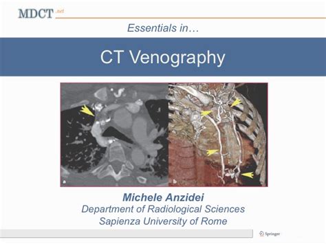 CT Venography - MDCT.net