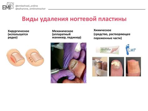Заболевания кожи. Заболевания ногтей - презентация онлайн