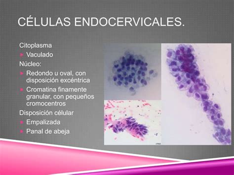 Atlas De Citología Ginecológica Benigna Ppt