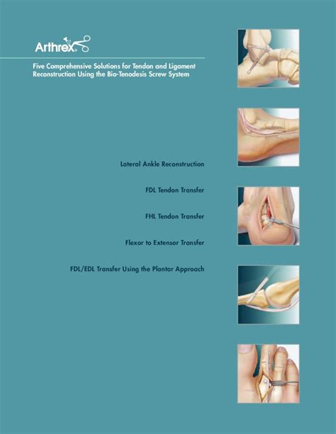 Pdf Five Comprehensive Solutions For Tendon And Ligament