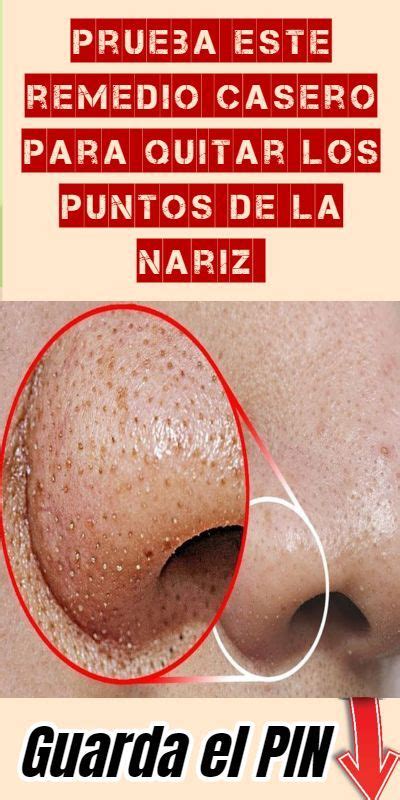 Como Quitar Los Puntos De La Nariz Con Pasta Dental Salud Eficaz