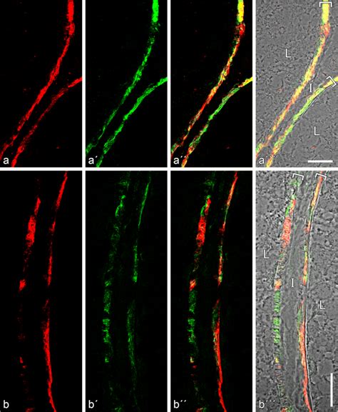 Higher Magnification Of Double Label Immunofluorescence Microscopy Of