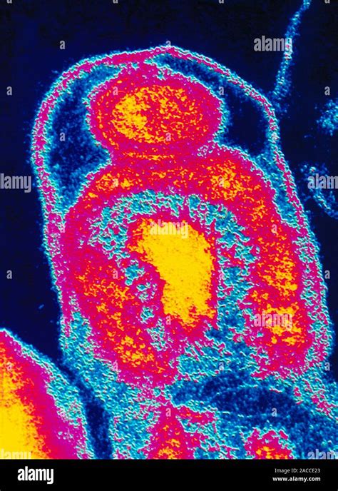 Coxiella Burnettii False Colour Transmission Electron Micrograph TEM