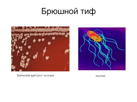 Что такое брюшной тиф: Брюшной тиф: симптомы, лечение, профилактика