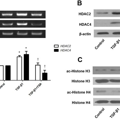 Effects Of Trichostatin A On Expression Of Snail And Slug Mrna And