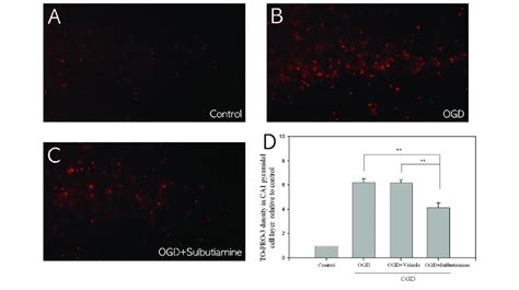 Neuroprotective Effect Of Sulbutiamine In Ogd Exposed Ca1 Hippocampal