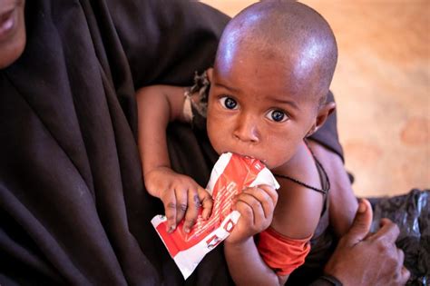 Somalie Environ 730 Enfants Sont Morts Dans Des Centres De Nutrition