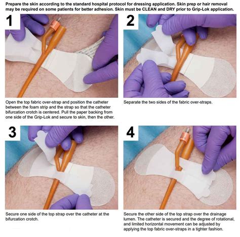 List Pictures How To Put A Catheter In A Woman Video Completed