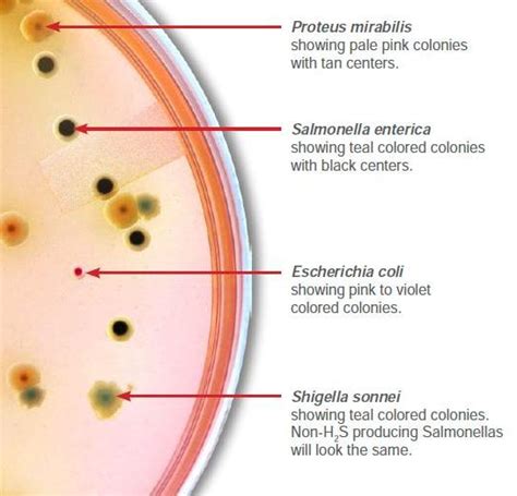 Proteus mirabilis antibiotic susceptibility