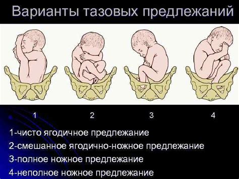 Положение Плода Продольное Предлежание Головное Фото — Mixyfotos.ru