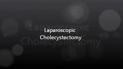 Laparoskopische Cholezystektomie Hd Doccheck