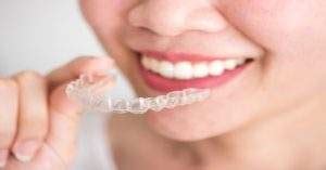 Aspectos Importantes Sobre Los Brackets Invisibles