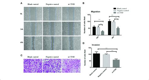 Effect Of CTSD On Migration And Invasion Of SACC LM Cells A B