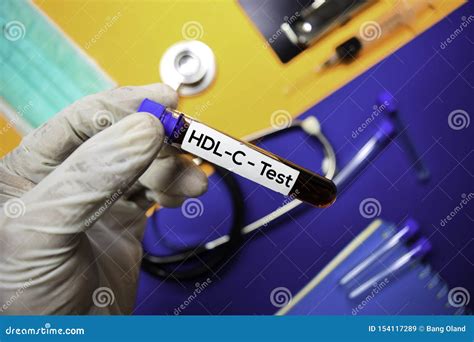 Hdl Exame Para Que Serve - Teste Do HDL-C Com Amostra De Sangue Vista Superior Isolada No Fundo Da ...