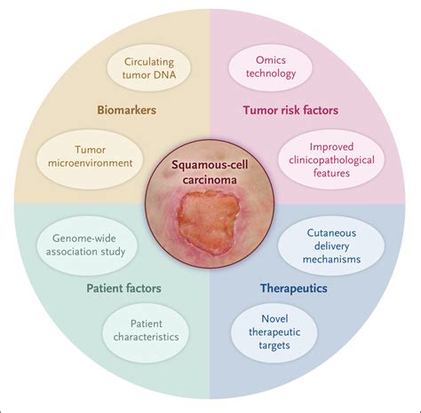 Squamous Cell Carcinoma Diagram