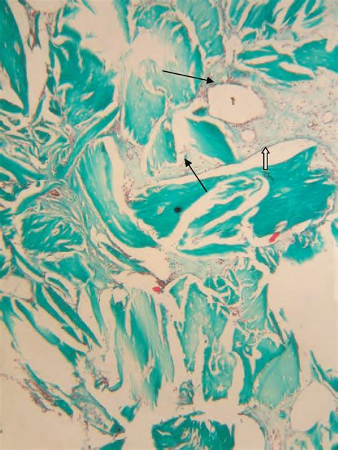 Photomicrograph Of Histological Section Stained With Goldner S