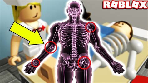 How To Break Every Single Bone In Your Body In Roblox Broken Bones