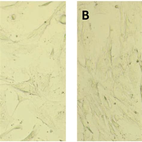 Morphology Of Mesenchymal Stem Cells Under Normoxic And Hypoxic