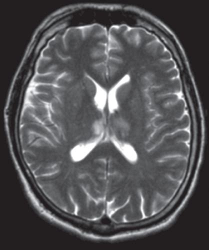 Magnetic Resonance Imaging Mri Flashcards Quizlet