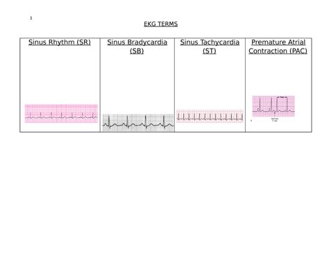 Ekg Chart Ekg Terms Sinus Rhythm Sr Sinus Bradycardia Sb Sinus Tachycardia St Premature