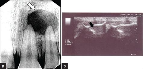 Digital Imaging In Endodontics Expeditionwoman