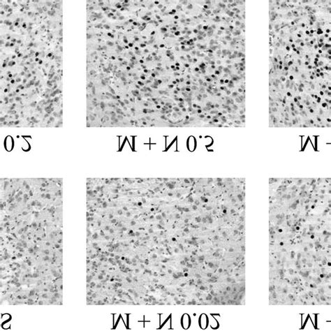 Representative Photomicrographs Showing Naloxone Induced C Fos