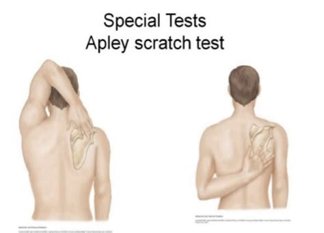 Opp Lab Upper Extremity Flashcards Quizlet