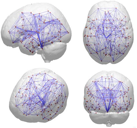 Structural Network Reconstructed In A Male Subject Aged 73