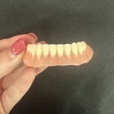 Dentures And Partial Dentures Image Gallery Buy Dentures Online